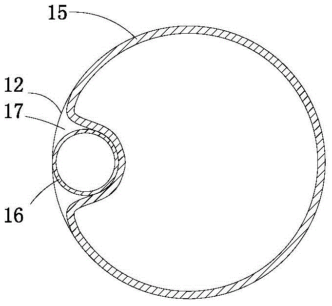 Lumen stent