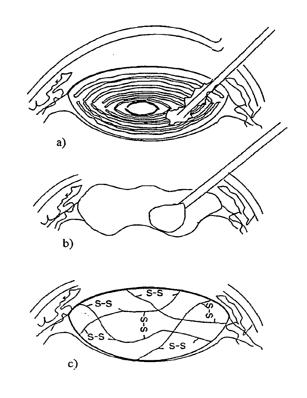 Hydrogel nanocomposites for intraocular lens applicatons