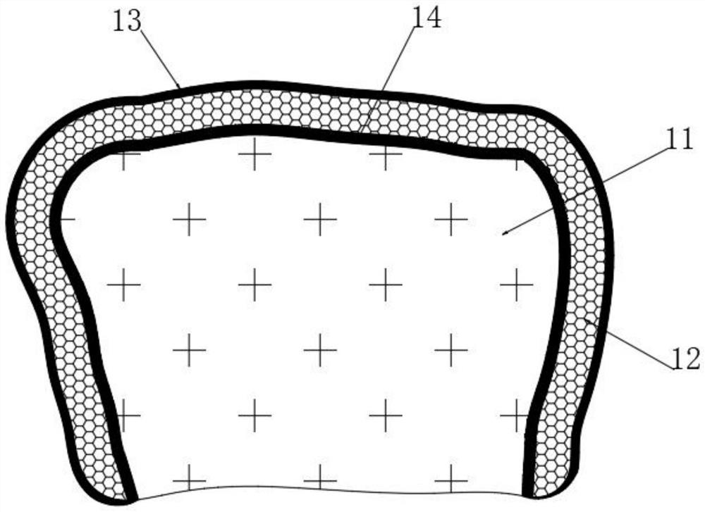 Customized radius head prosthesis based on three-dimensional anatomy of proximal radius on uninjured side