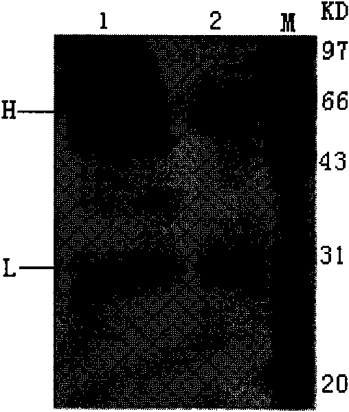 Recombinant yeast for expressing antibody or antibody analogue as well as construction method and application thereof