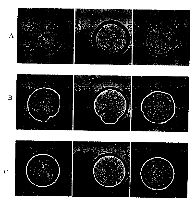 Method for locating circular algae in microimage