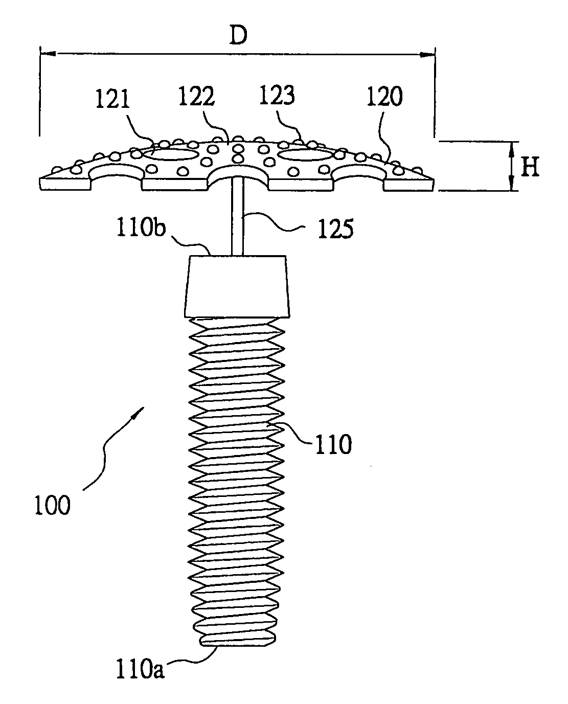 Titanium-mesh umbrella device for bone grafting