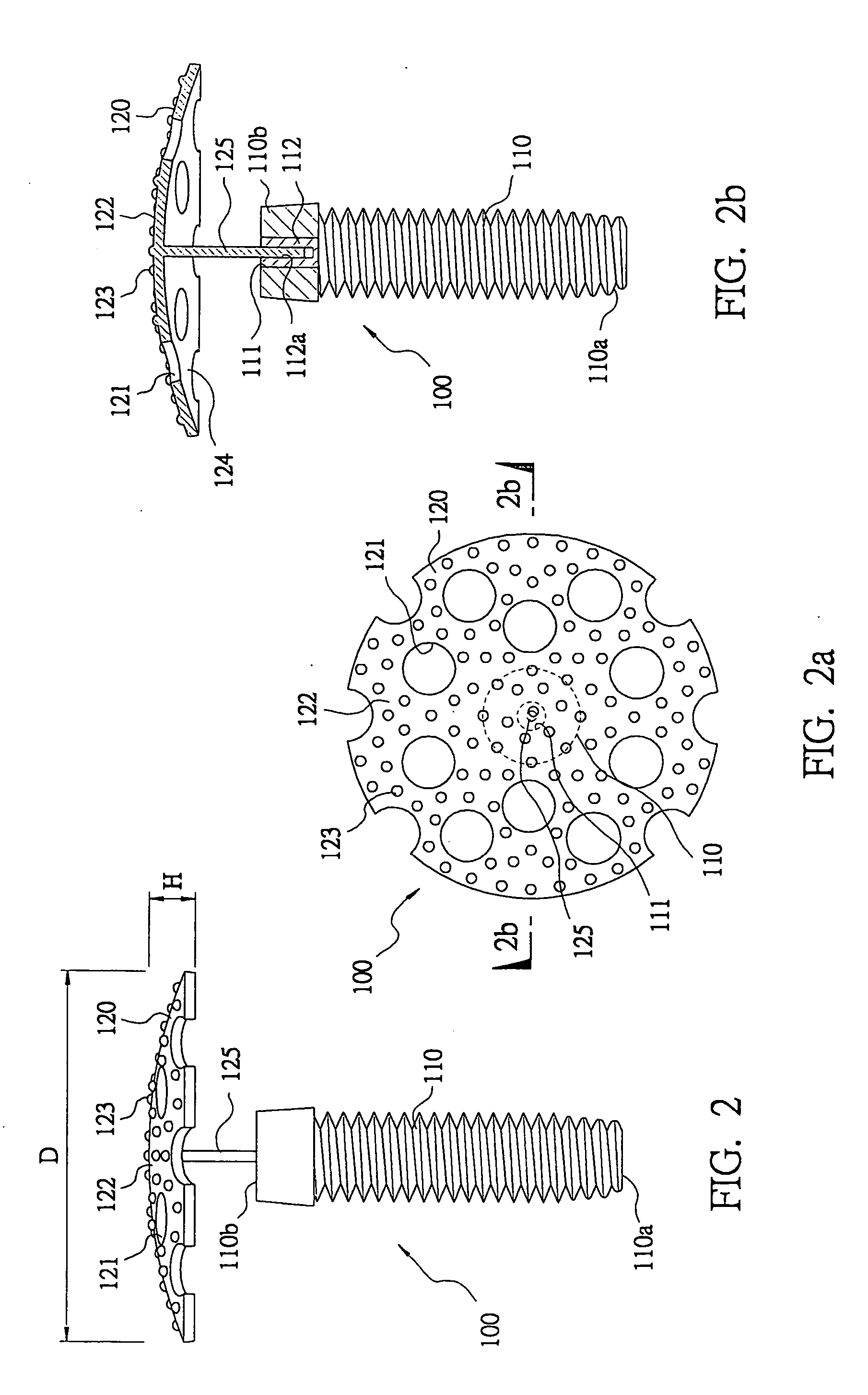 Titanium-mesh umbrella device for bone grafting