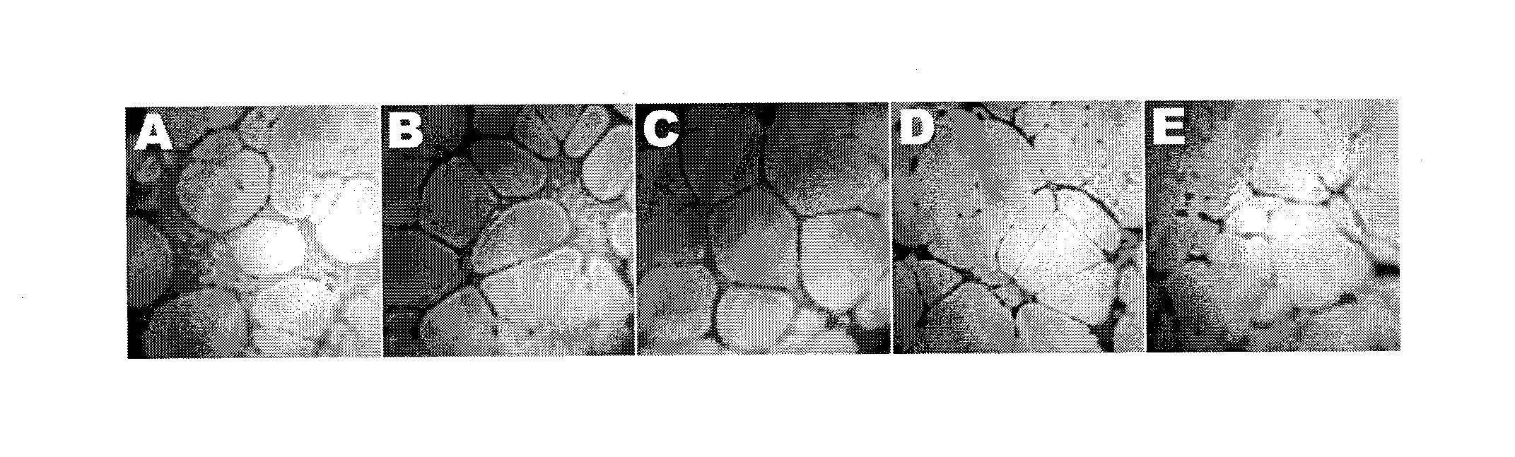 Method for treatment of diseases