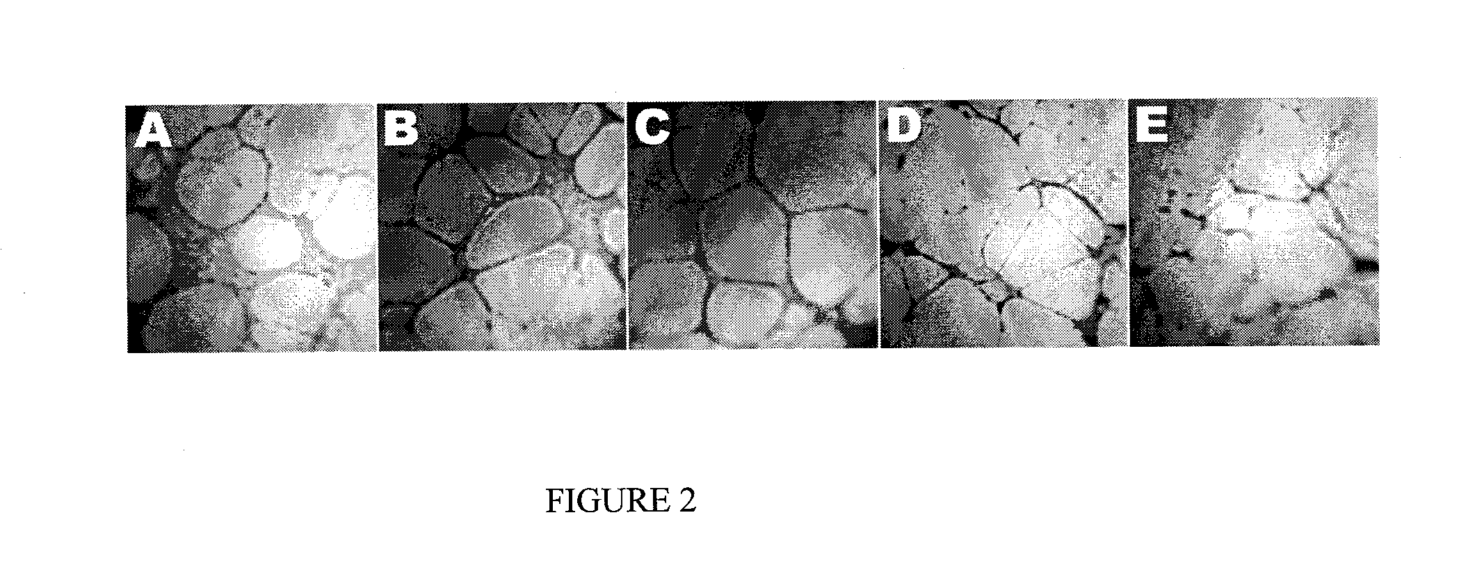 Method for treatment of diseases