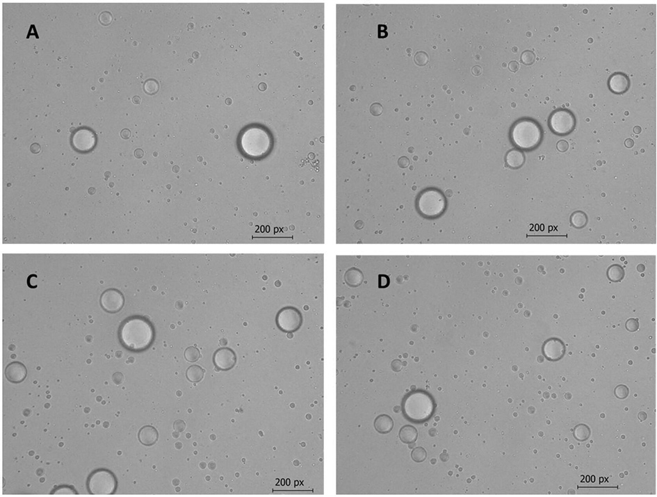 Preparation method of amomum villosum essential oil microcapsule