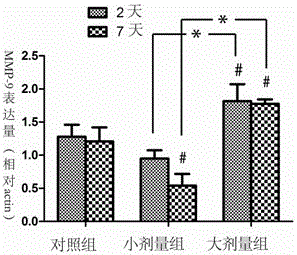 Combined application of statin and adrenocortical hormone medicaments to treatment of chronic subdural hematoma