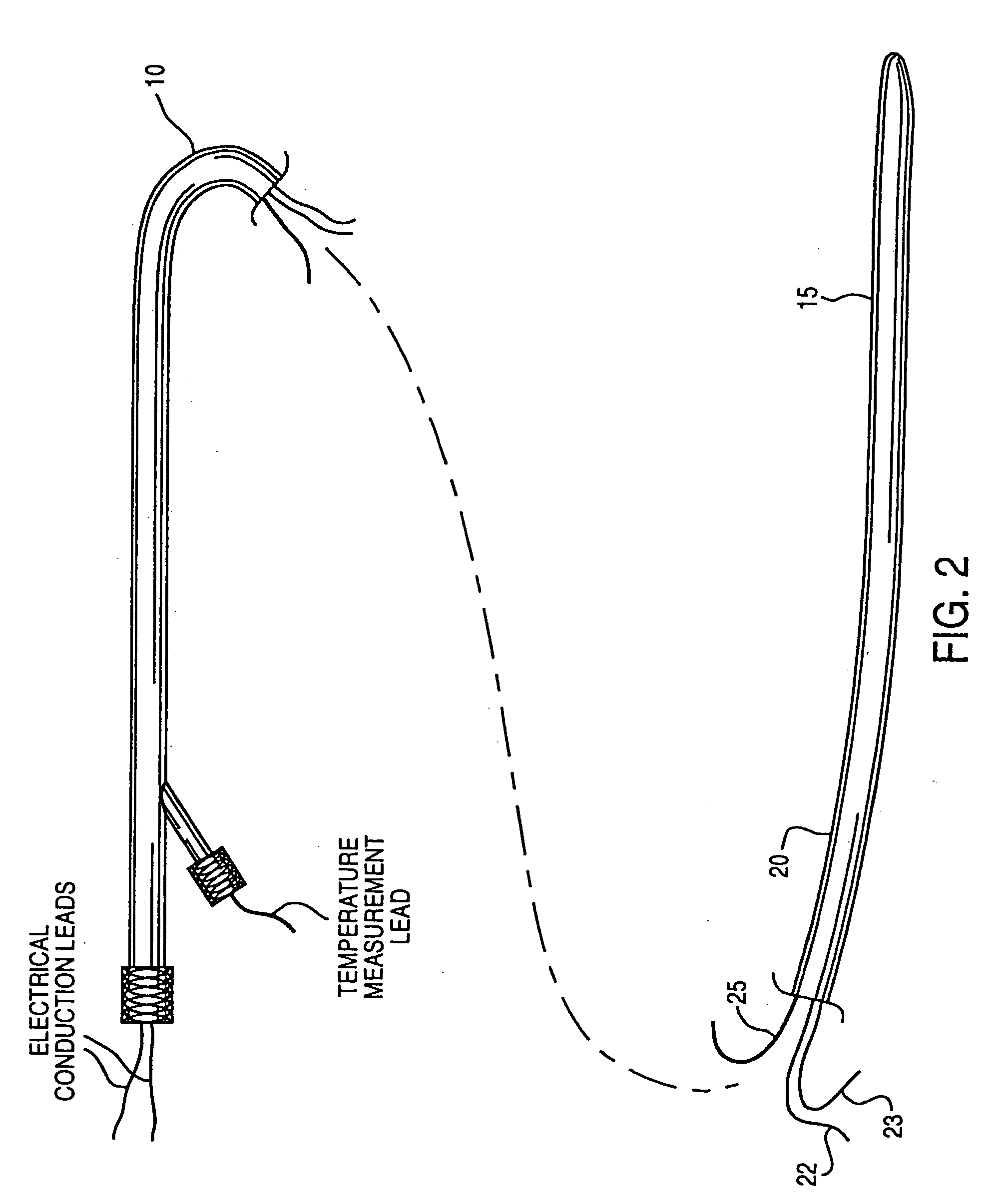 Method and apparatus for controlling a patient's body temperature by in situ blood temperature modification