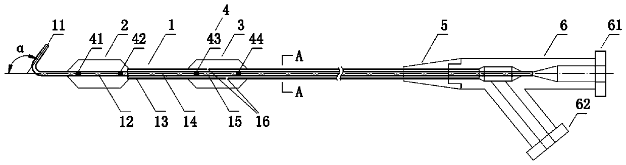 A double-balloon catheter for occlusion of blood flow in the common iliac artery