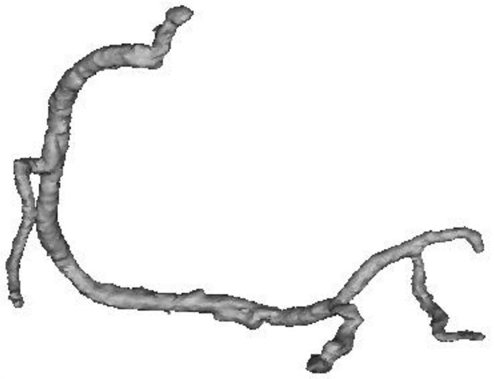 Coronary artery lesion functional quantitative method based on deep learning and neutrosophy theory