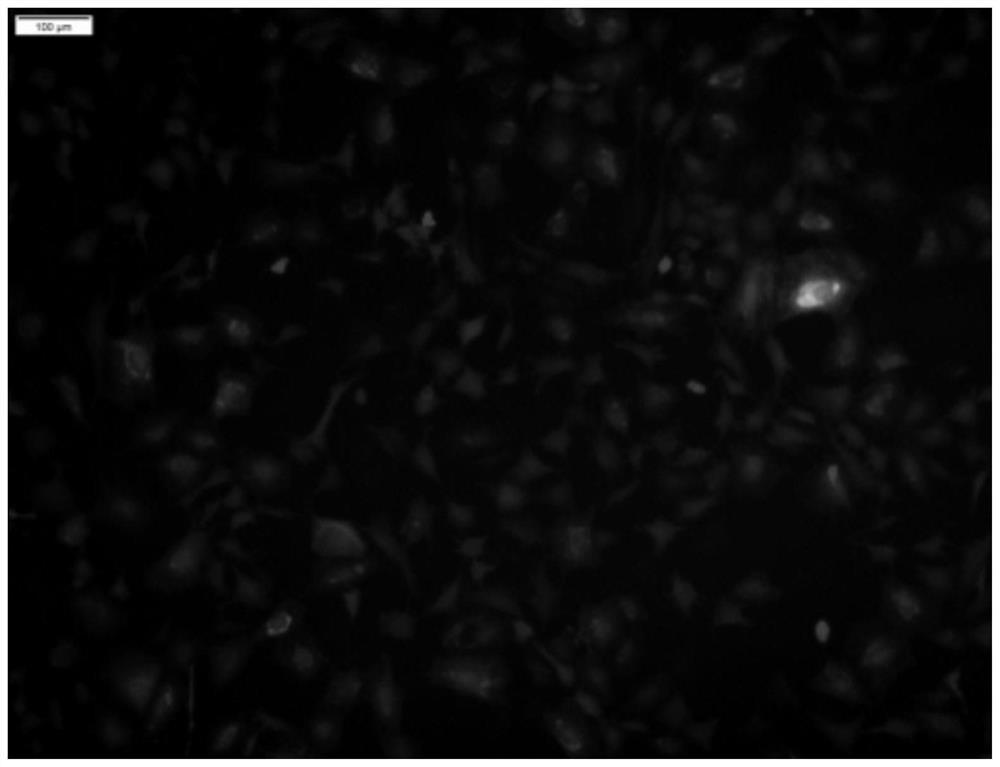 Method for stably expressing secretable human insulin in mesenchymal stem cells