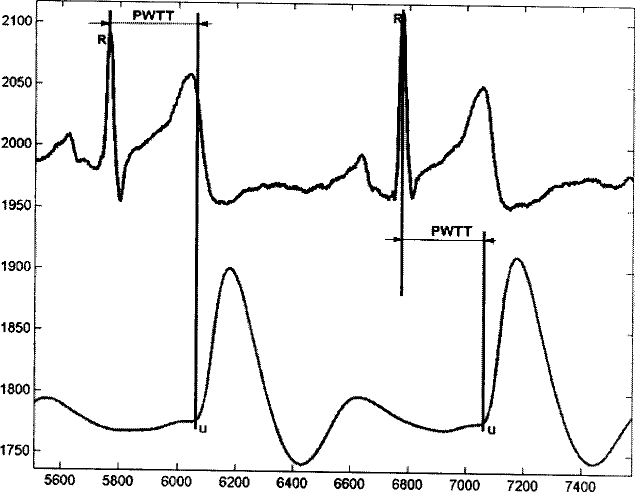 Method and apparatus for continuously measuring blood pressure