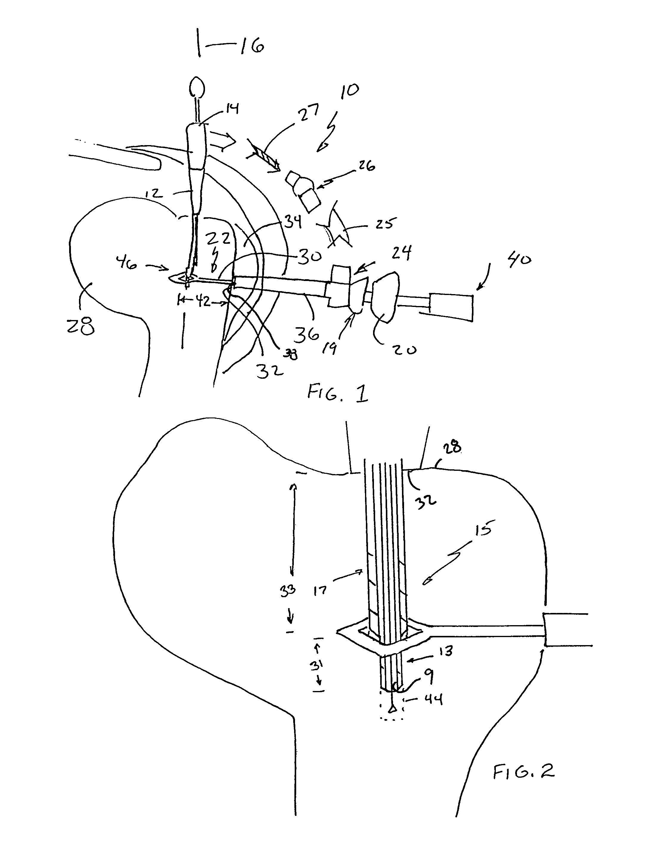 Surgical drill guide with awl and method of use