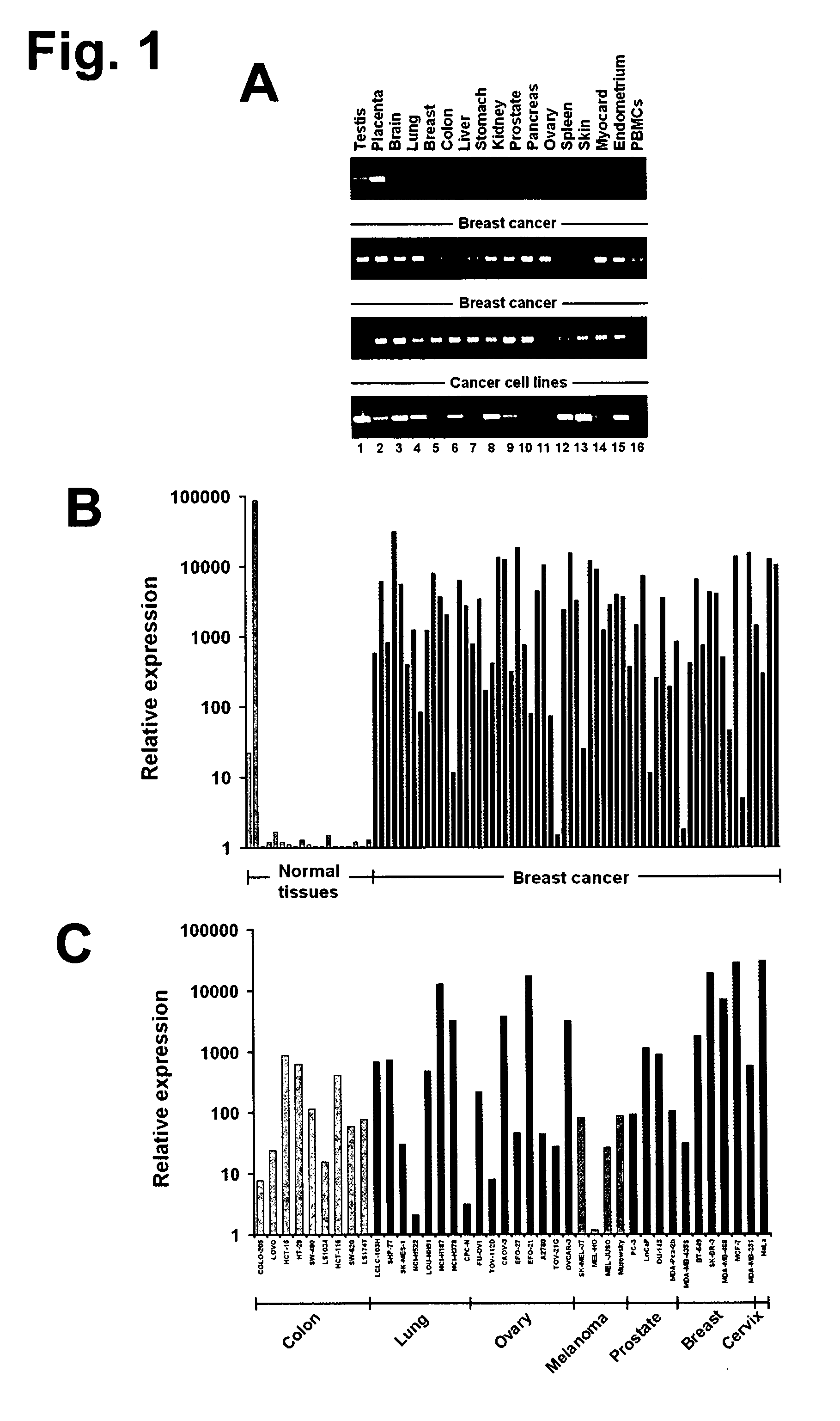 Monoclonal antibodies for treatment of cancer