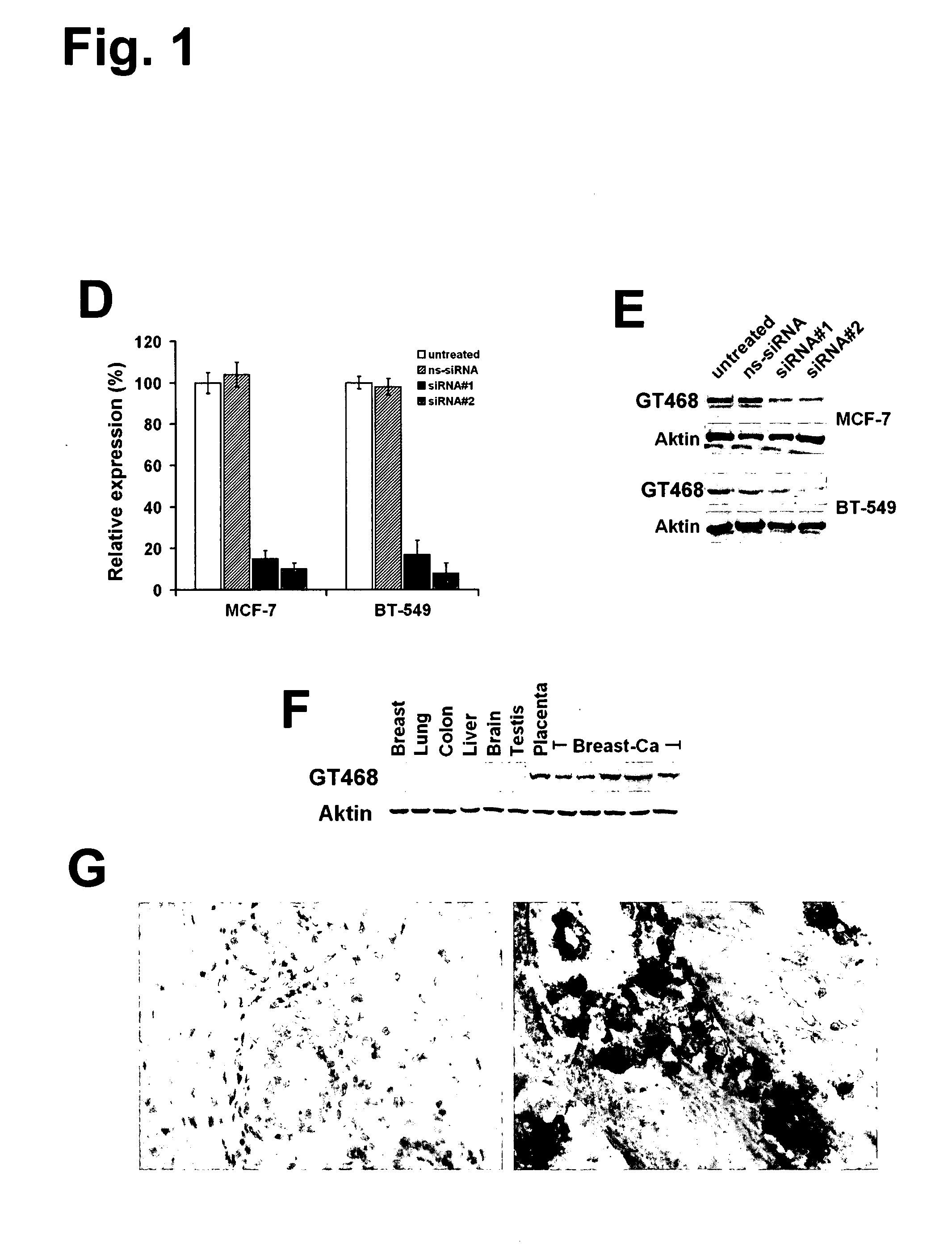 Monoclonal antibodies for treatment of cancer