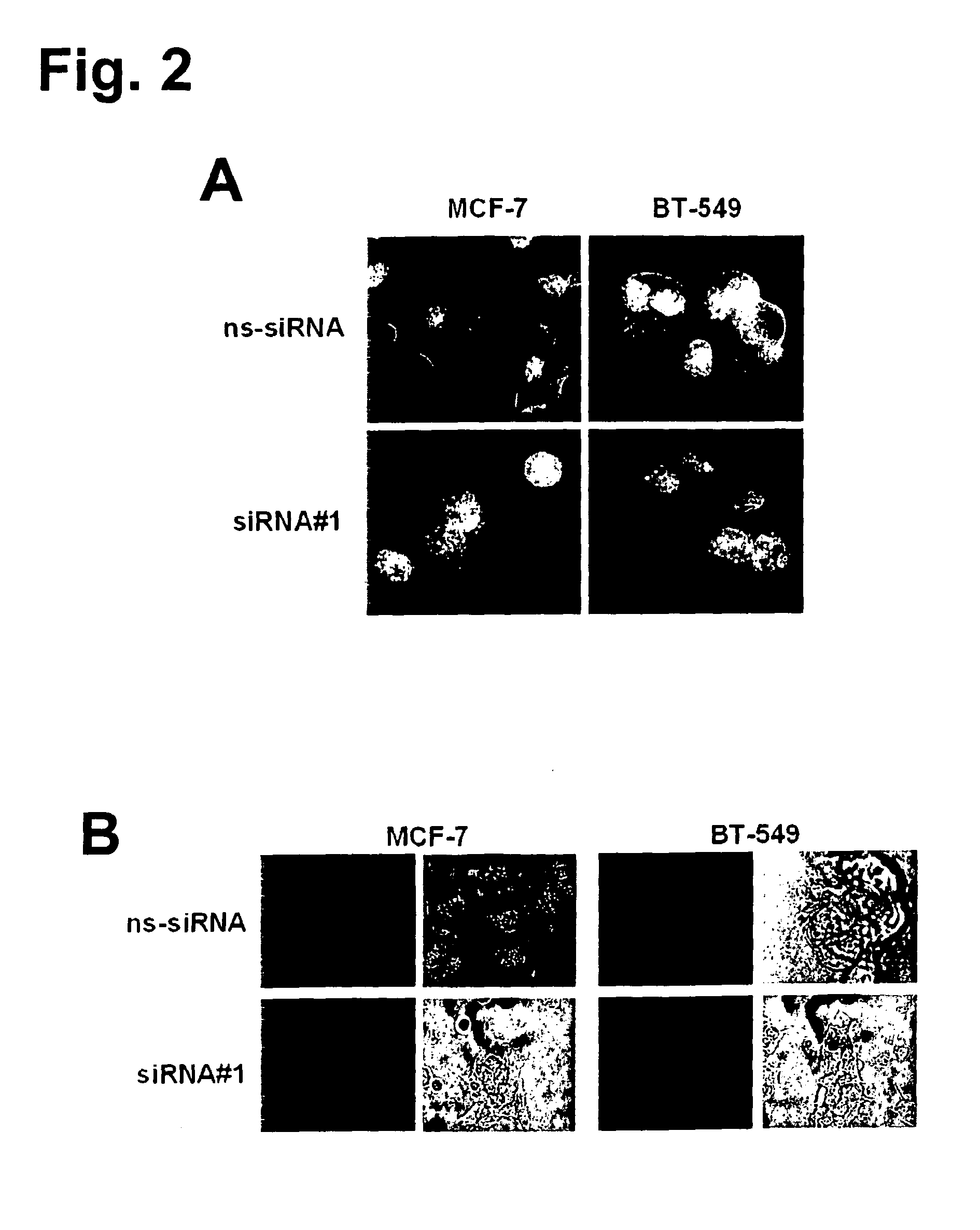 Monoclonal antibodies for treatment of cancer