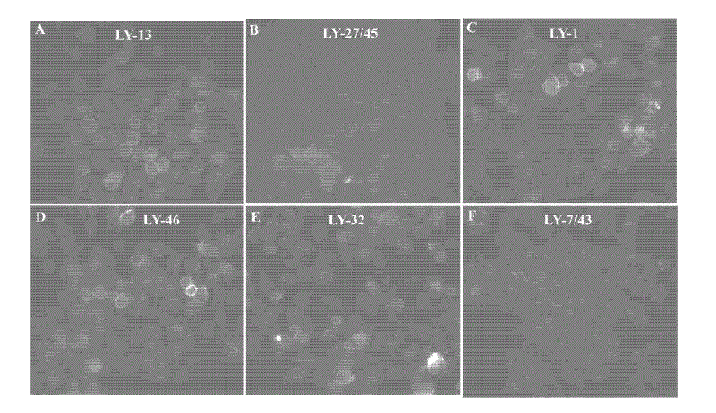 Single-stranded deoxyribonucleic acid (ssDNA) aptamer targeting human highly metastatic hepatoma carcinoma cell and application thereof