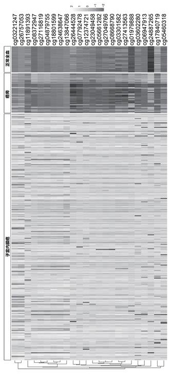 Detection kit for TMEM101 gene methylation in human peripheral blood circulating tumor DNA for early screening of endometrial cancer