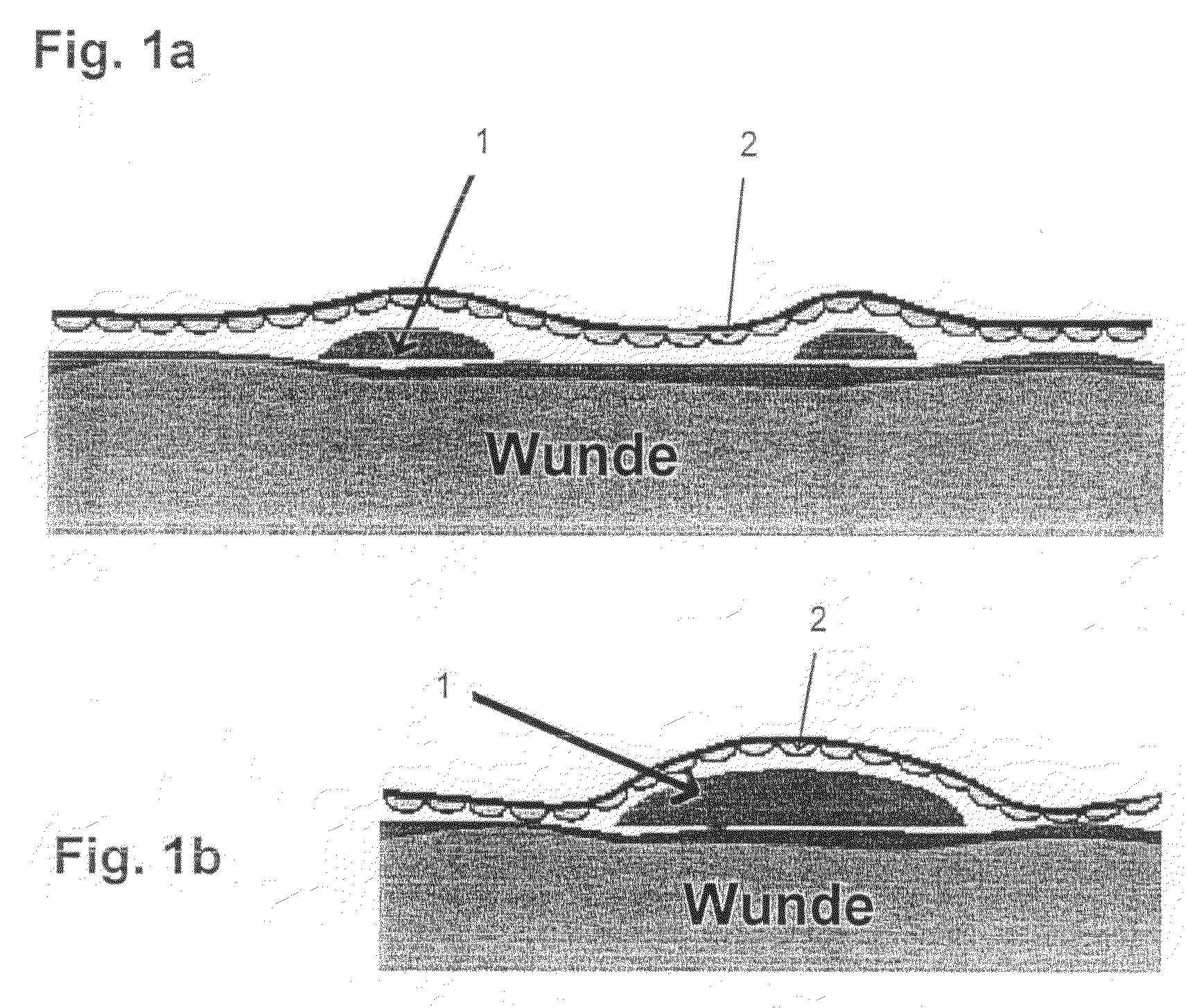 Artificial “arterio-venous” permeable hollow fiber capillary system