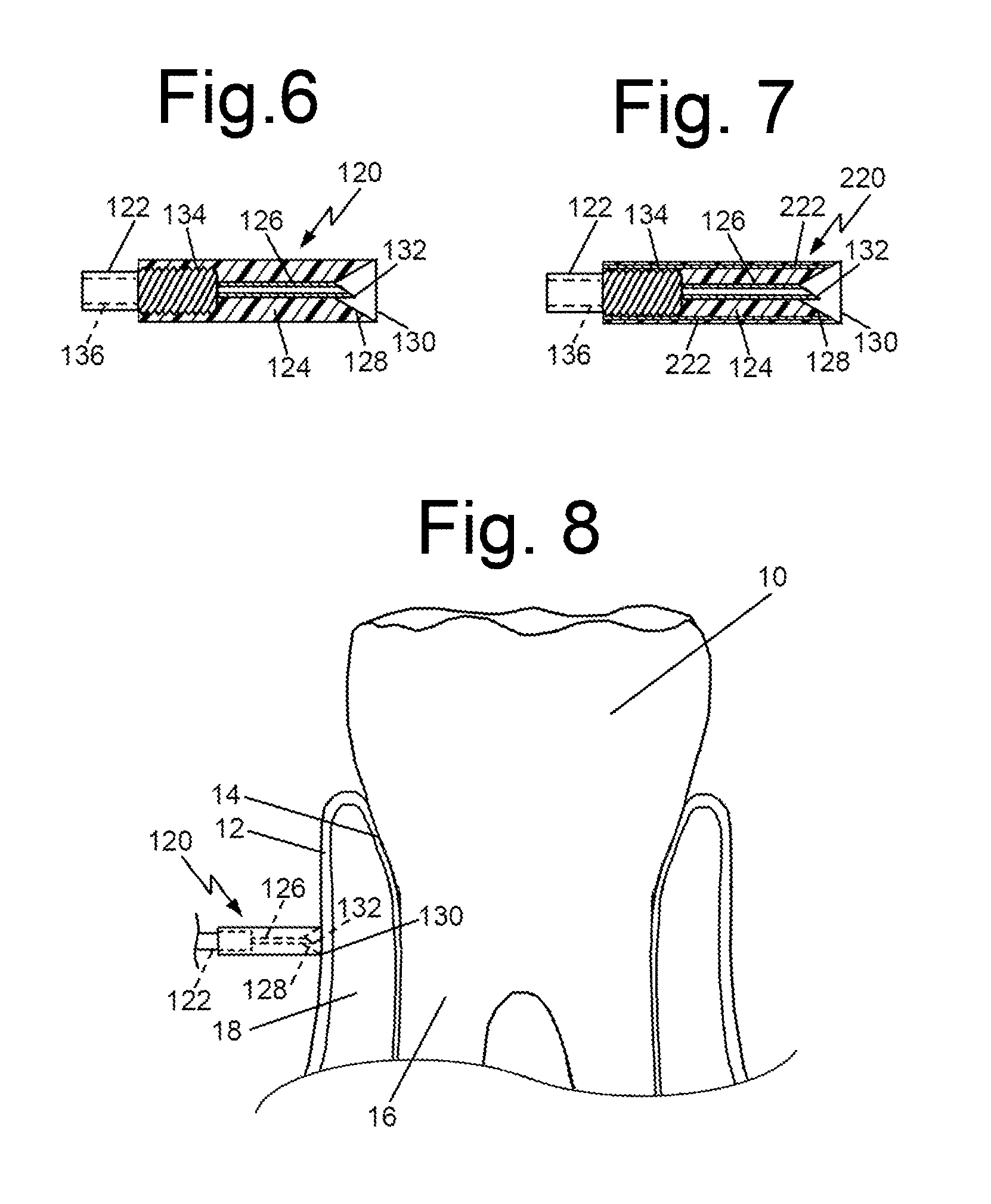 Articulating applicators/injectors for administration of liquid anesthetic and other liquids