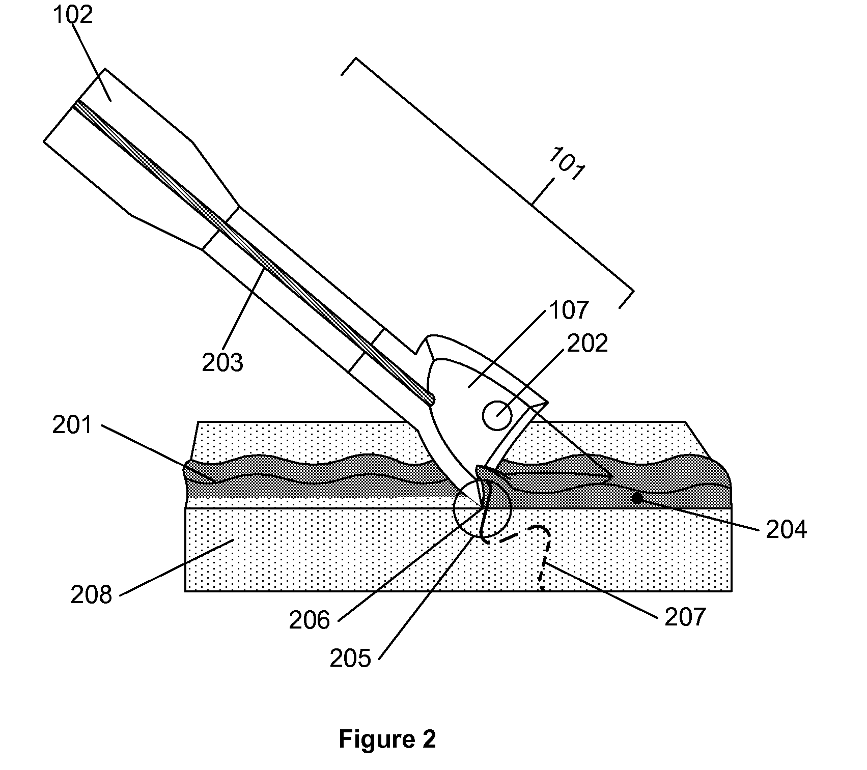 Method for debriding wounds