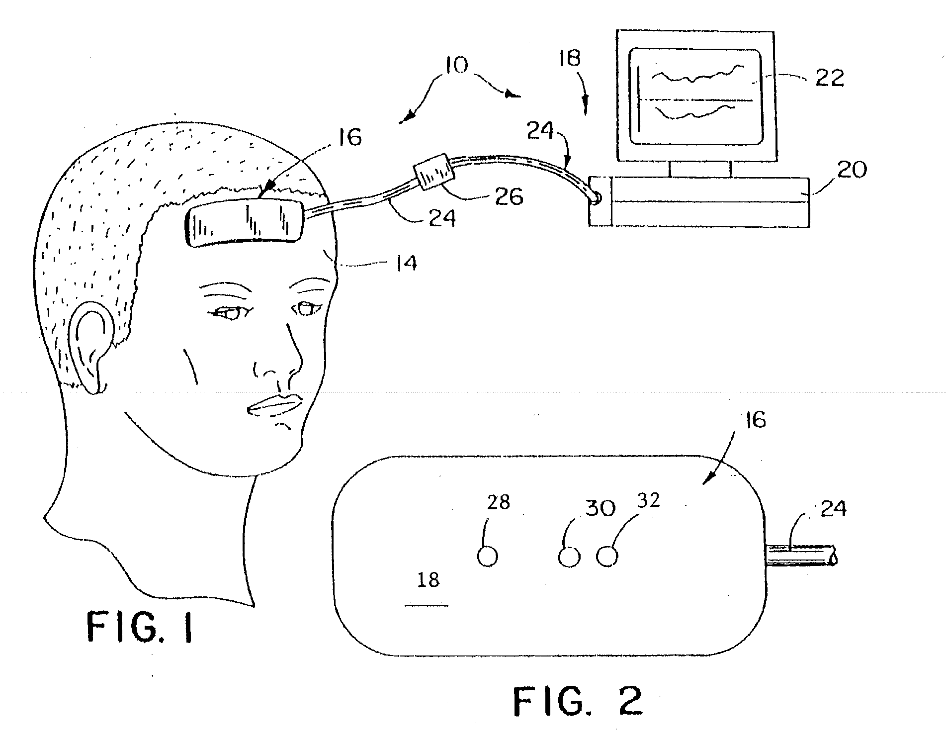 System and method of resolving outliers in nirs cerebral oximetry