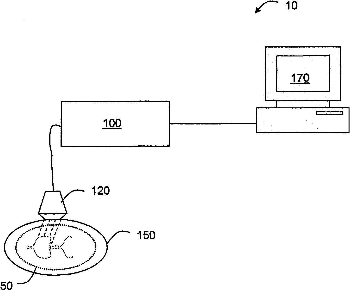 Method and system for imaging vessels