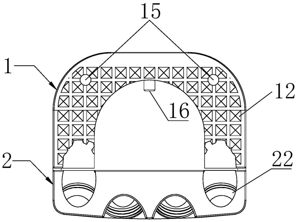 Anterior cervical zero-profile intervertebral fusion