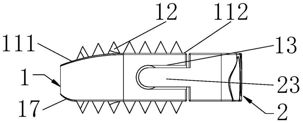 Anterior cervical zero-profile intervertebral fusion