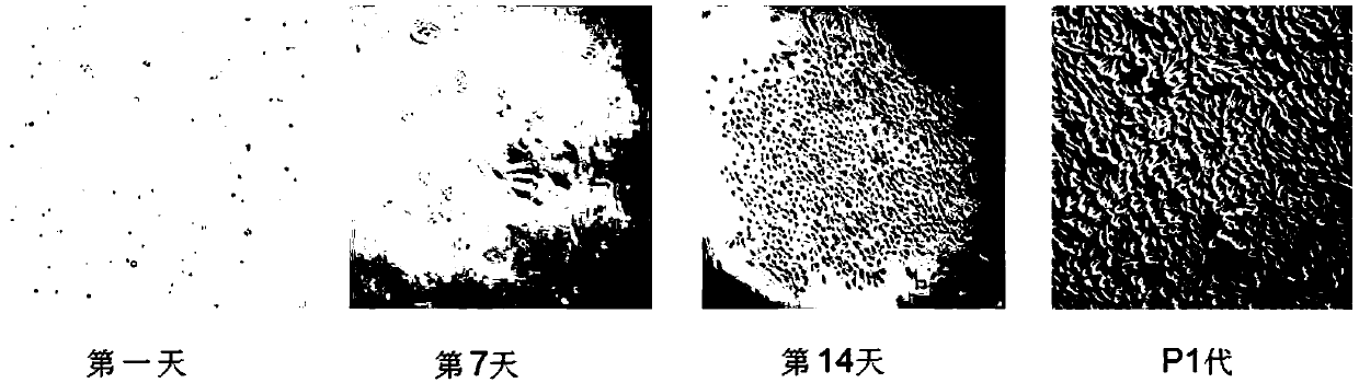 Preparation method and application of normal stem cells separated and cultured from urine of mitochondria mt3243AG mutation groups