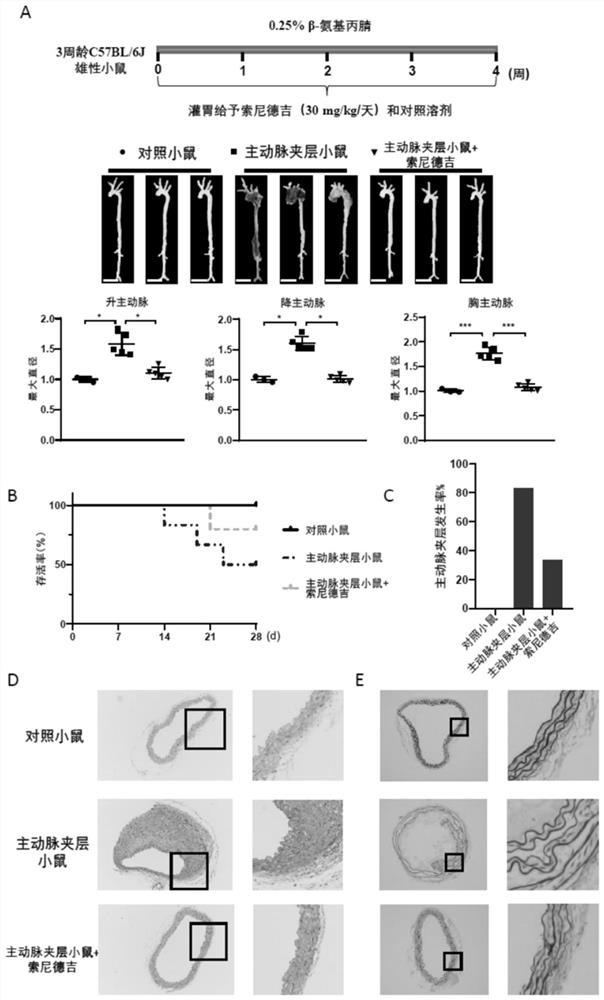 Pharmaceutical application of Sonidegib in treatment of aortic dissection