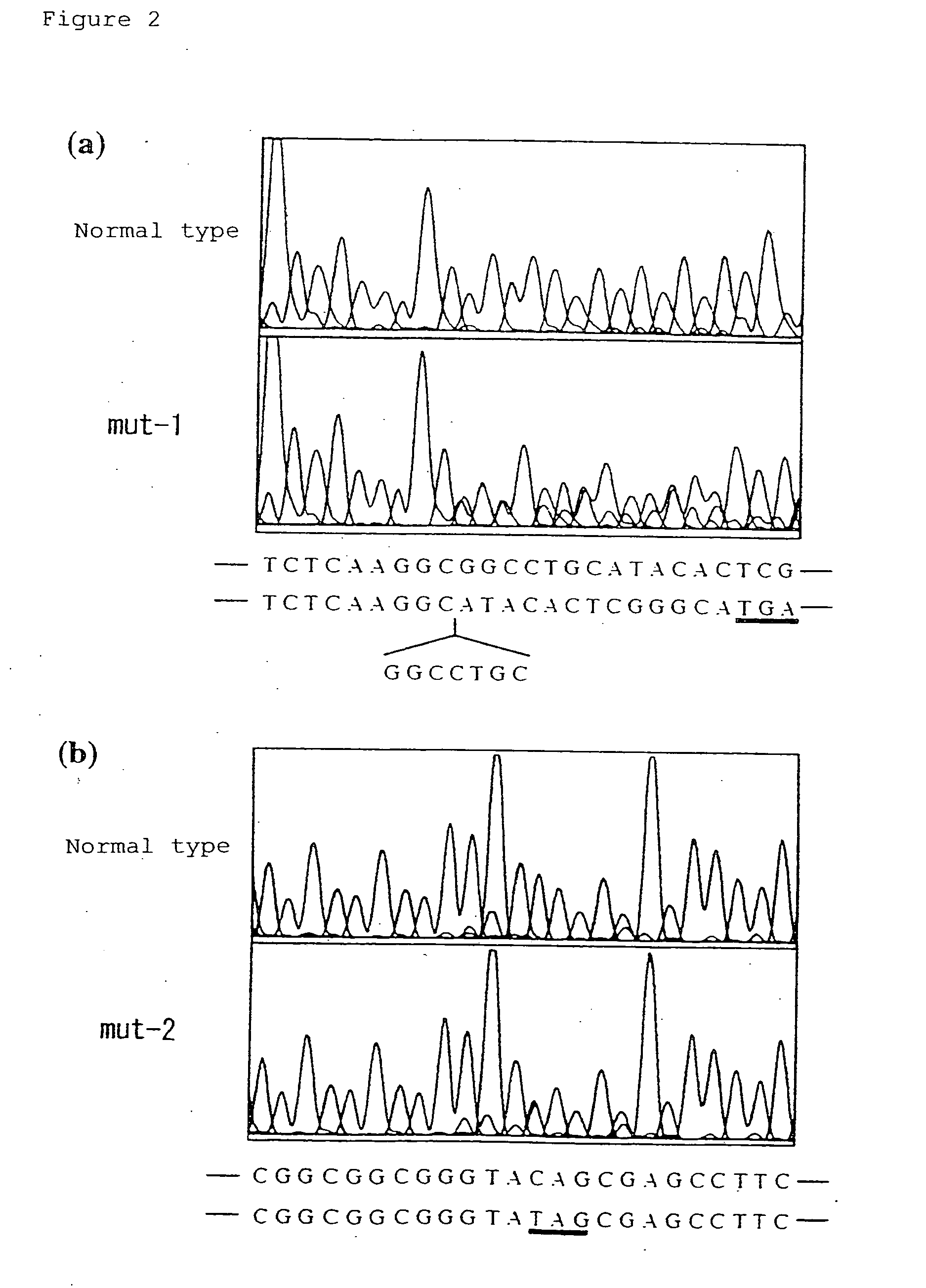 Gene causative of Rothmund-Thomson syndrome and gene product