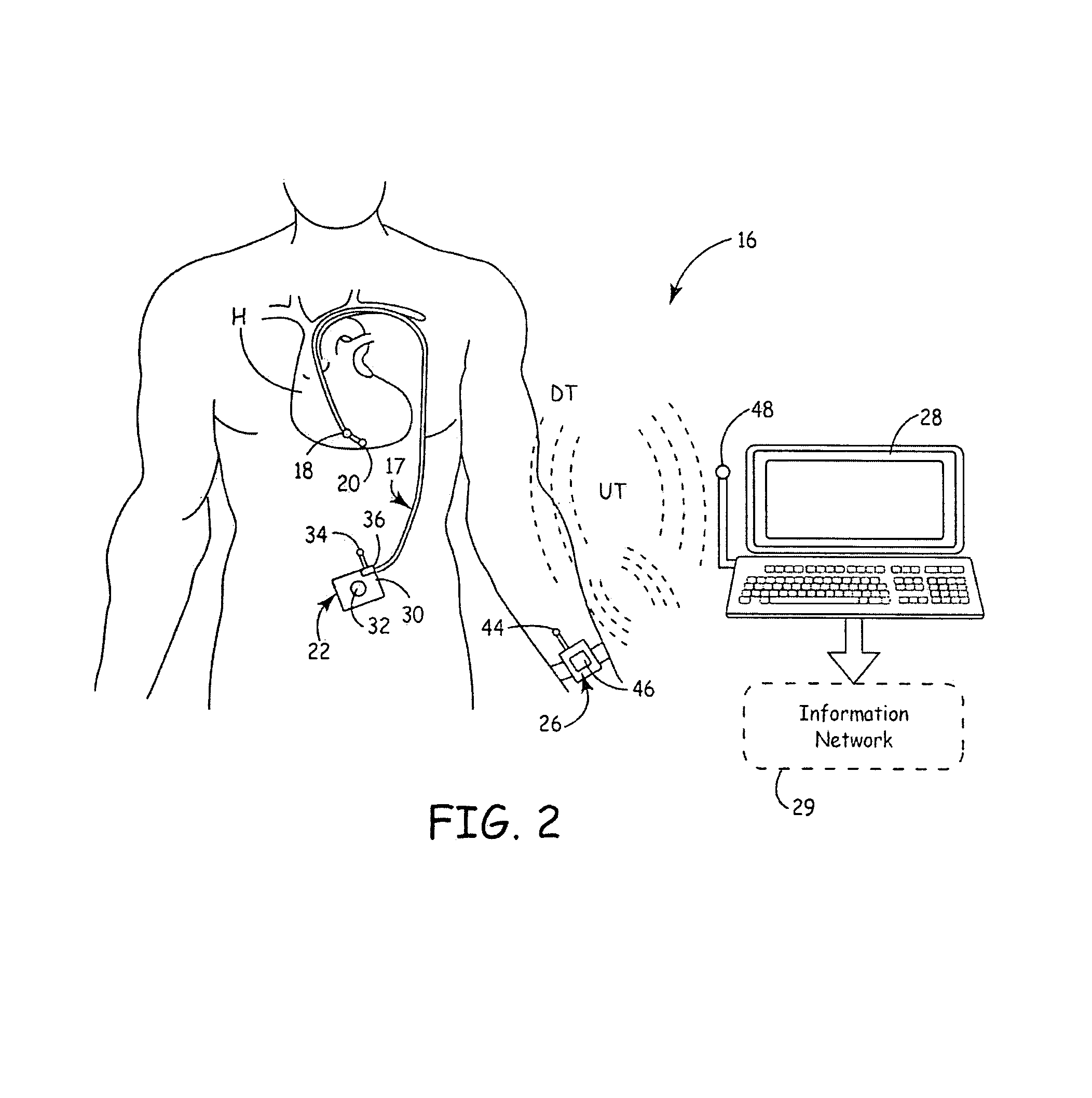 System and method for detecting cardiovascular health conditions using hemodynamic pressure waveforms