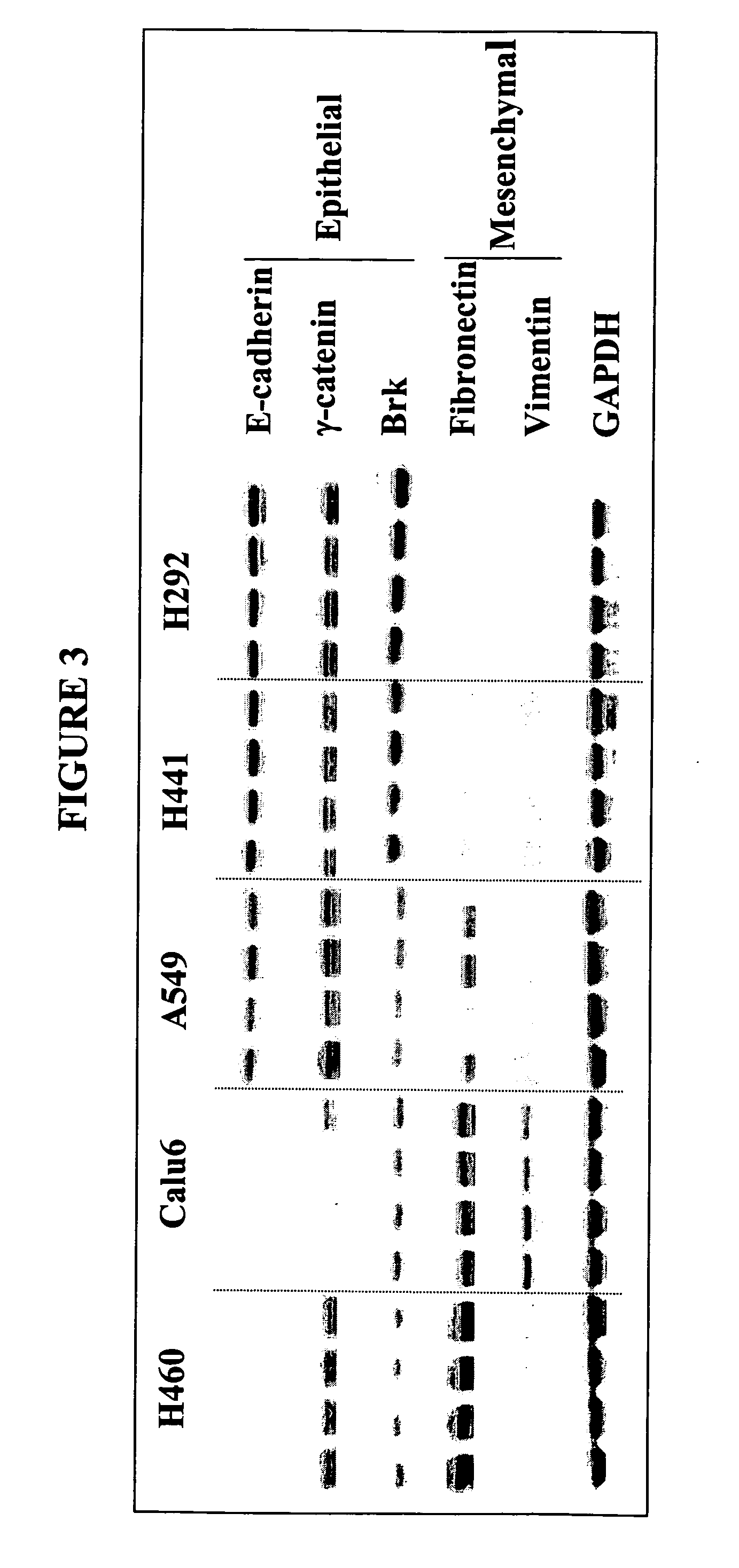 Biological markers predictive of anti-cancer response to insulin-like growth factor-1 receptor kinase inhibitors