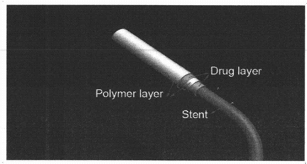 Preparation method of multi-coating drug eluting intravascular stent