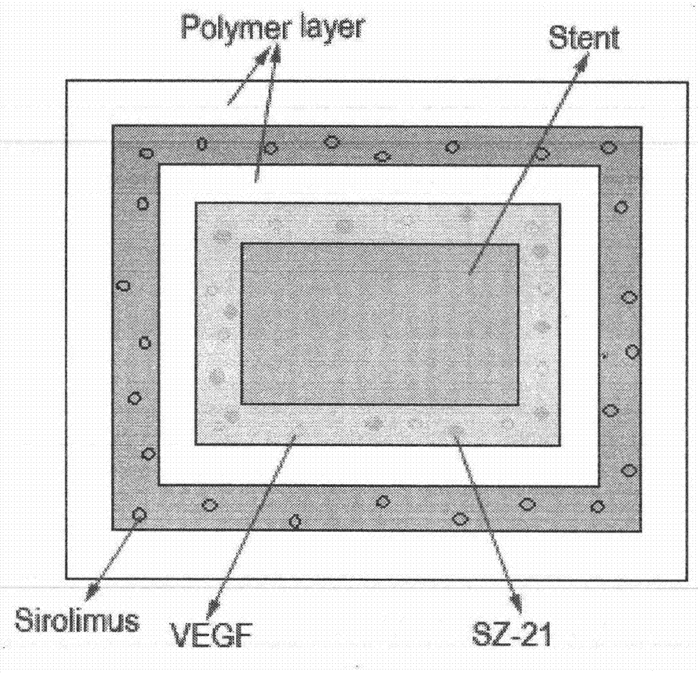 Preparation method of multi-coating drug eluting intravascular stent