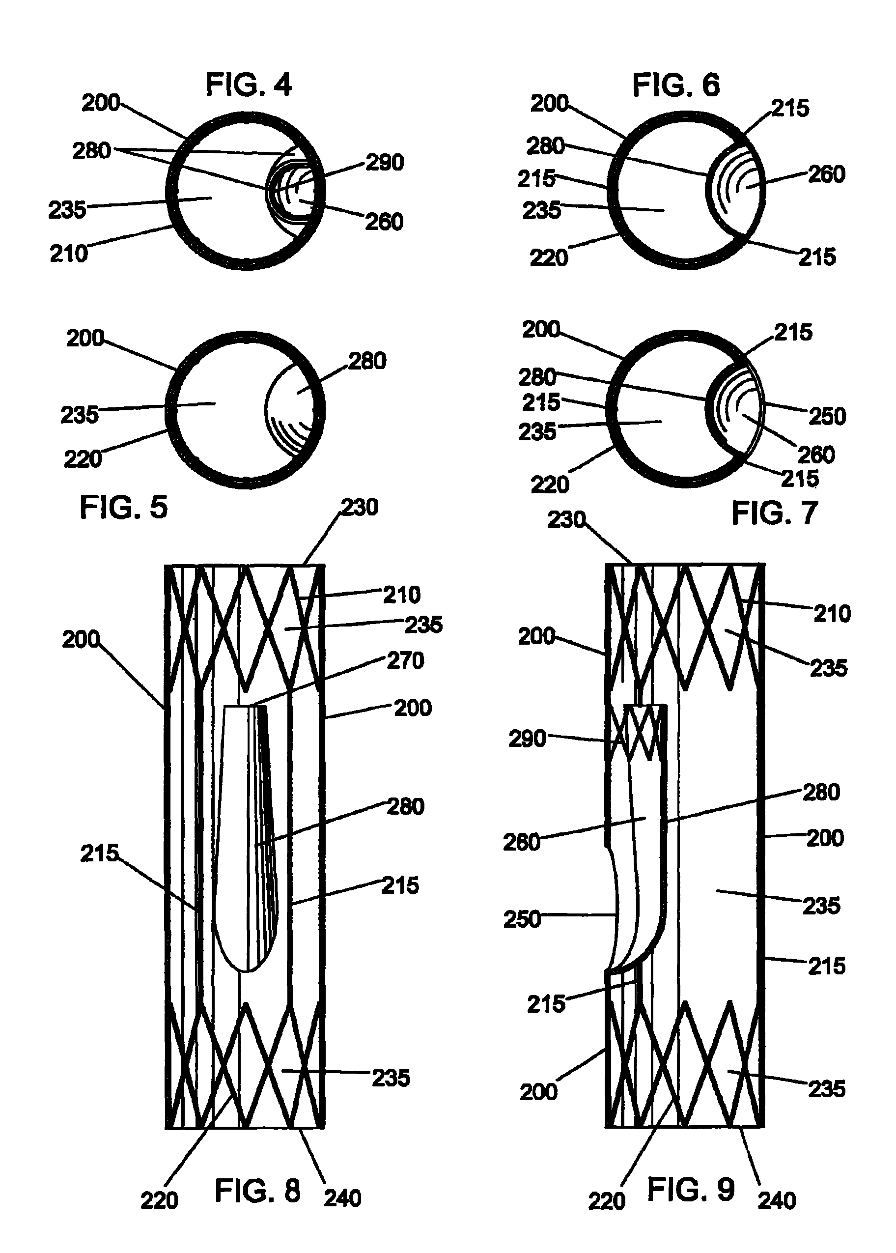 Method of deploying a bifurcated side-access intravascular stent graft