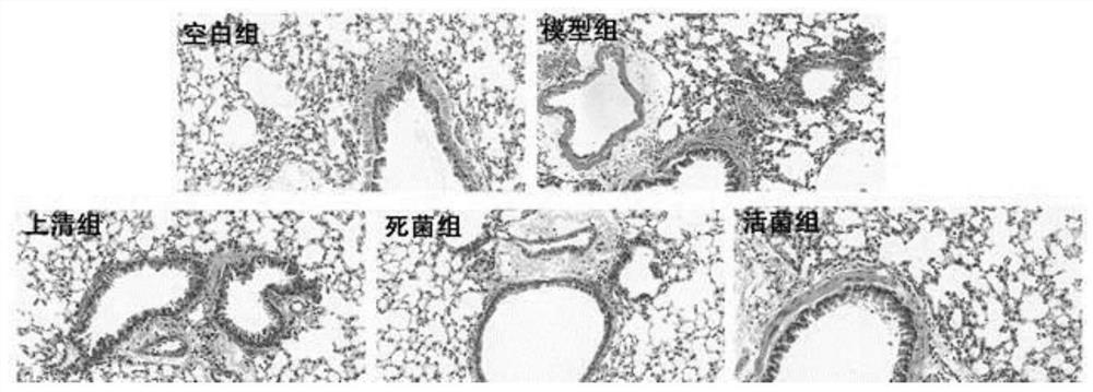 Application of Faecalibacterium prausnitzii in relieving allergic asthma and rhinitis Th2 reaction