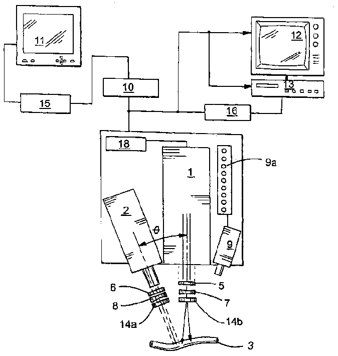 Method and apparatus for performing intra-operative angiography