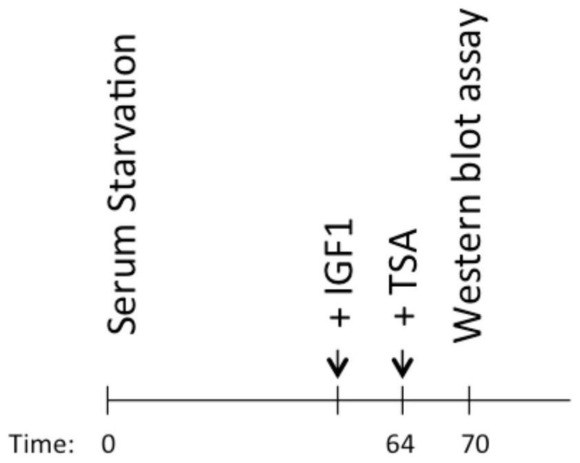 Sirt1-T177 site phosphorylation as a biomarker in aging-related diseases