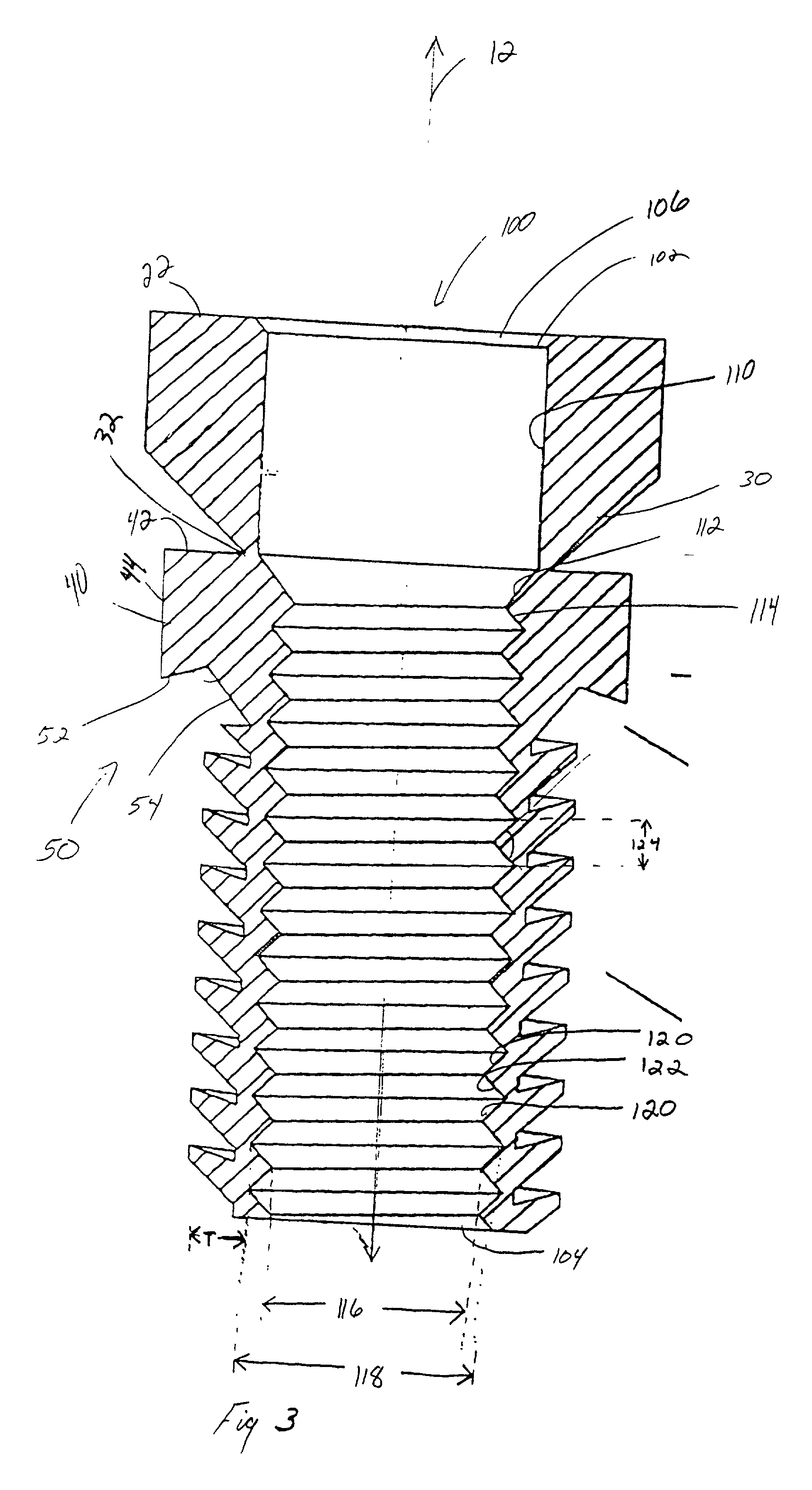 Thread repair insert