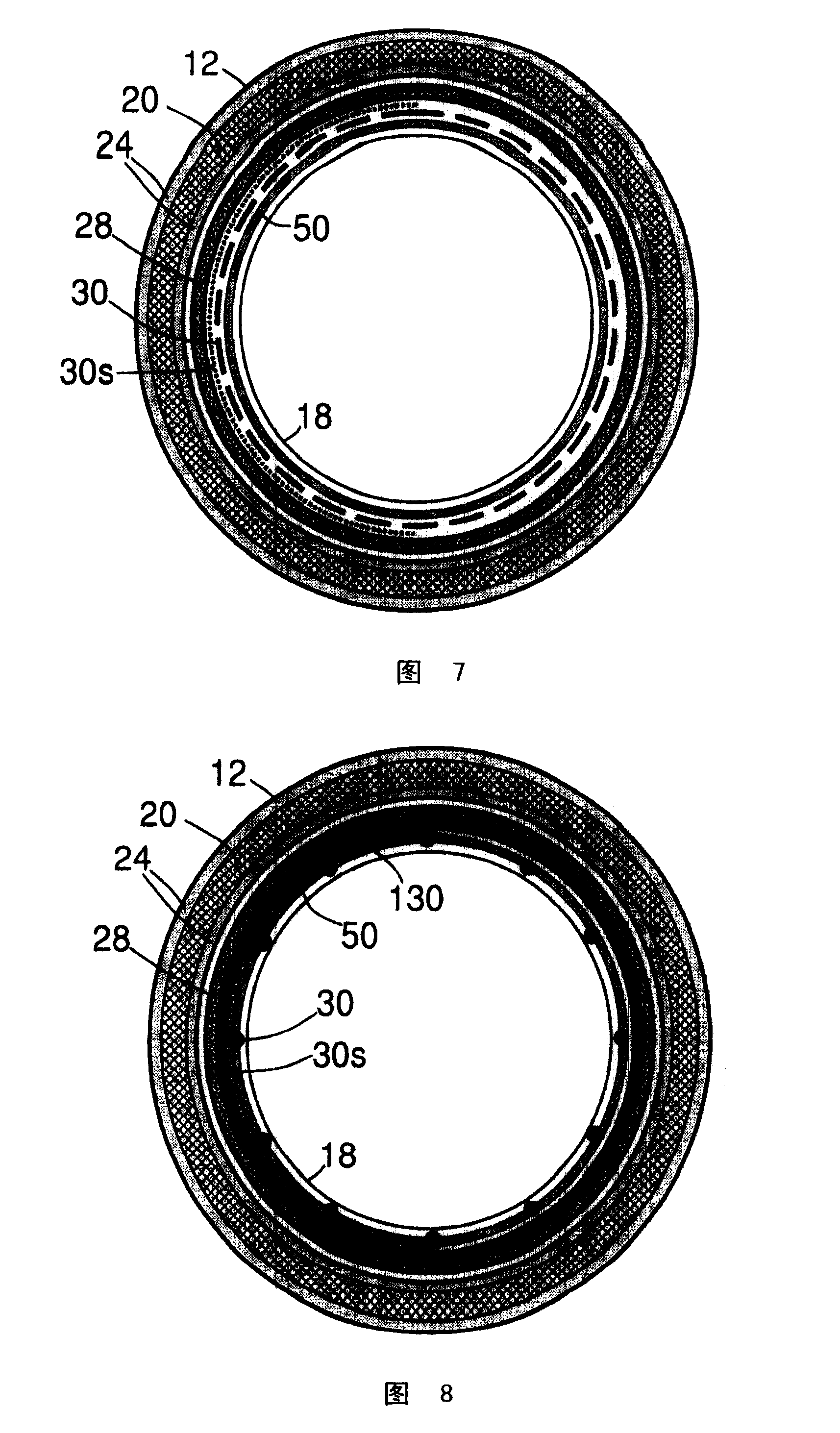 Pet/mr scanner with time-of-flight capability