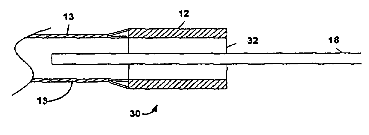 Ultrasonic transducer