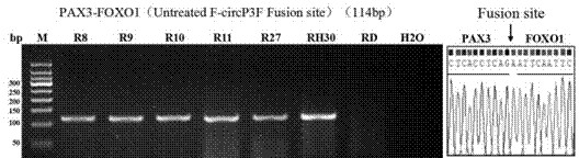 Kit and method for detecting F-circP3F in rhabdomyosarcoma