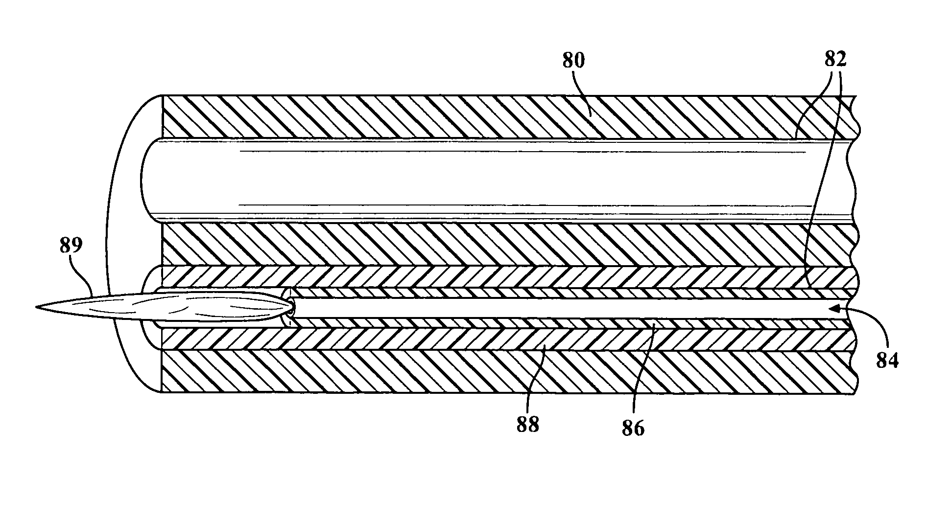 Method and apparatus for cold plasma treatment of internal organs