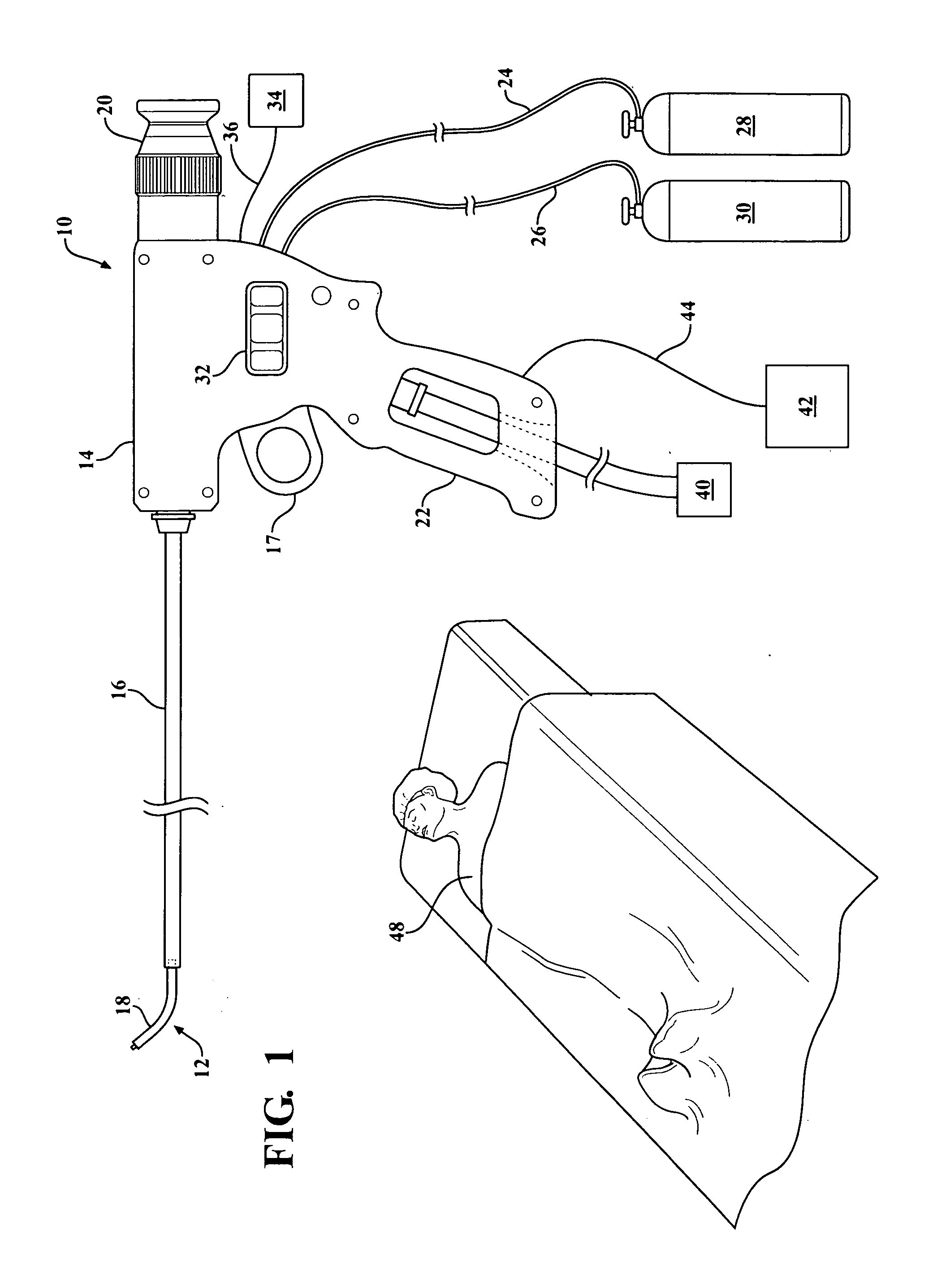 Method and apparatus for cold plasma treatment of internal organs