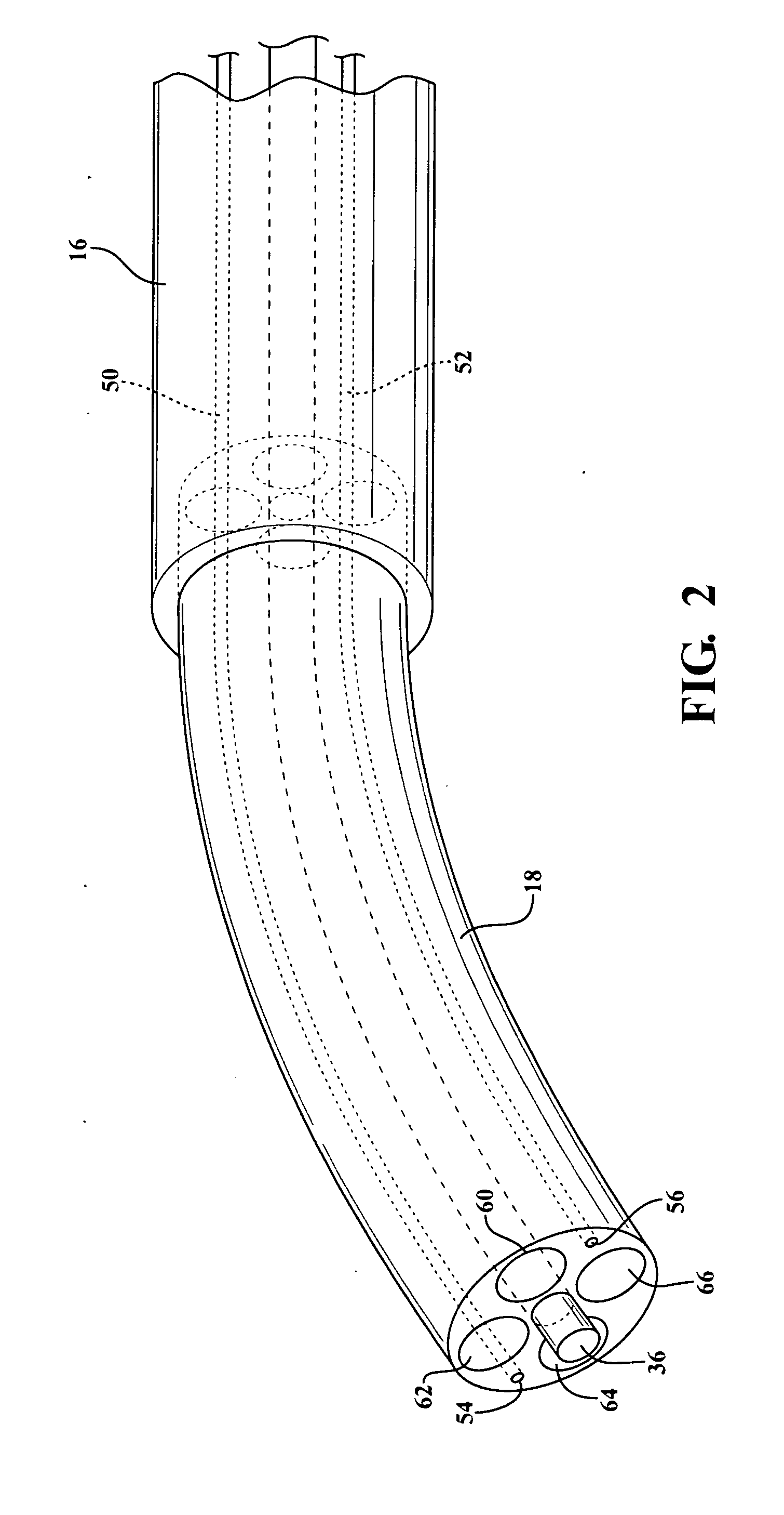 Method and apparatus for cold plasma treatment of internal organs