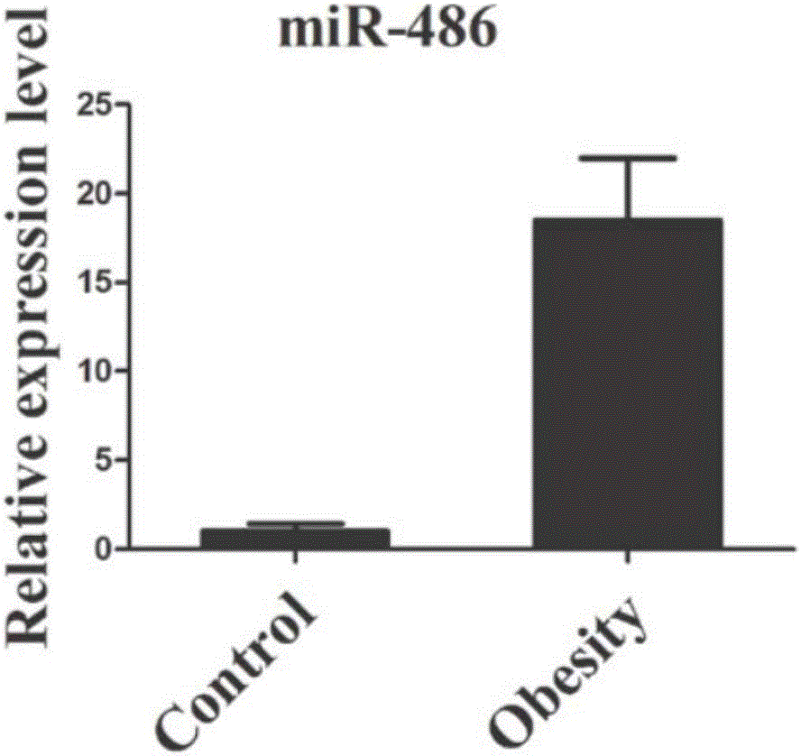 Serum or plasma miRNA marker related to diabetes mellitus type 2 and application thereof