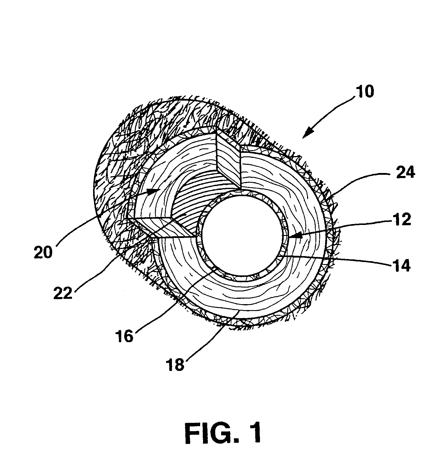 Transmural concentric multilayer ingrowth matrix within well-defined porosity