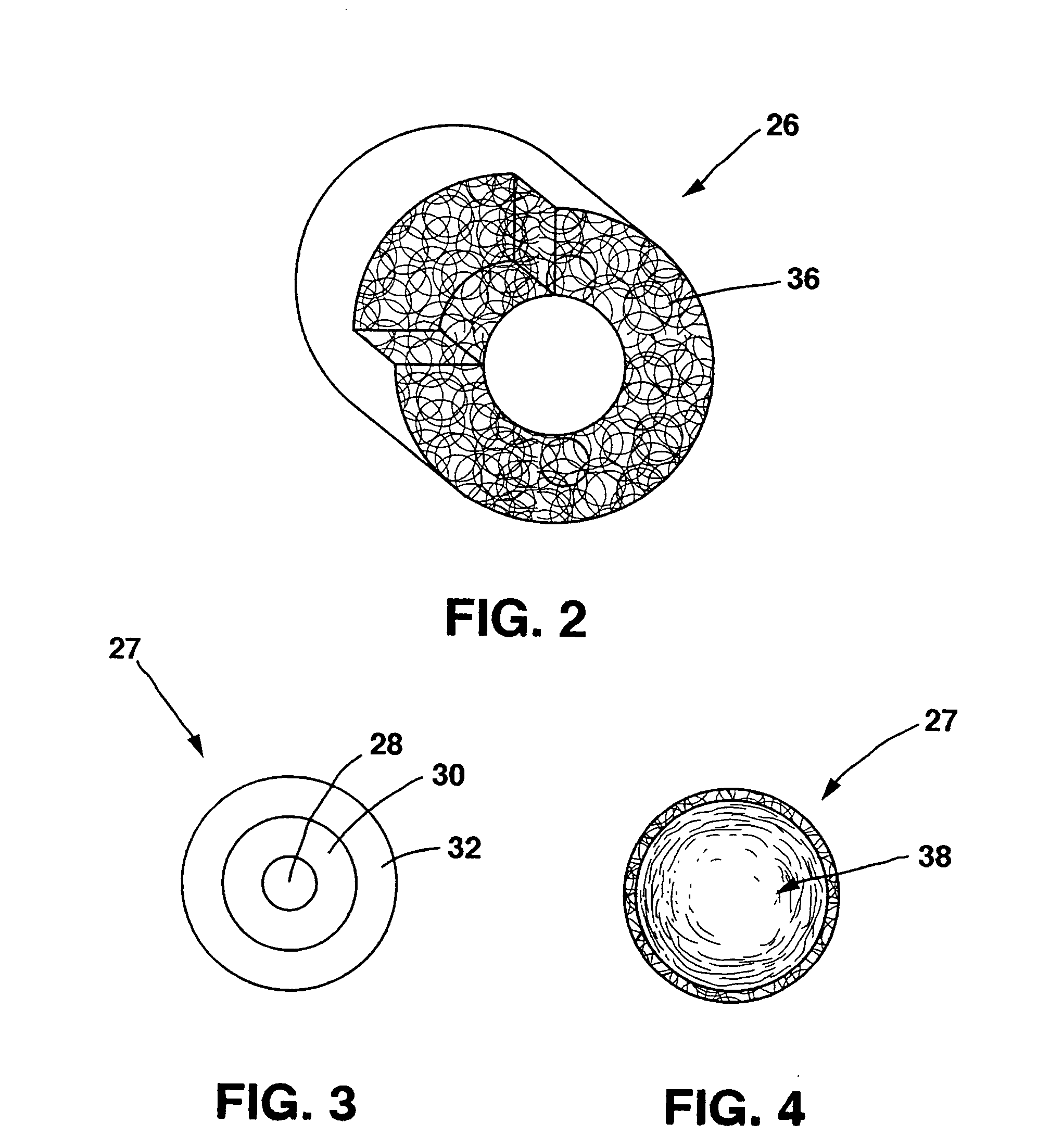 Transmural concentric multilayer ingrowth matrix within well-defined porosity